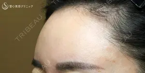 3555 days after image