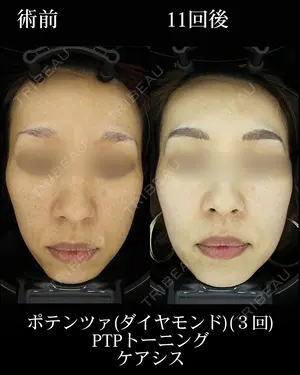 500 days after image