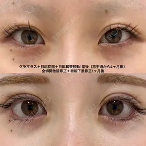 null days after image