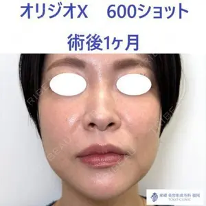 null days after image