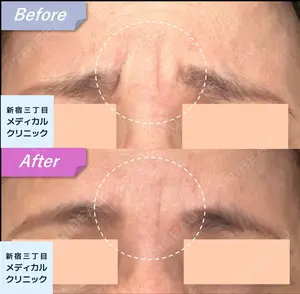 null days after image