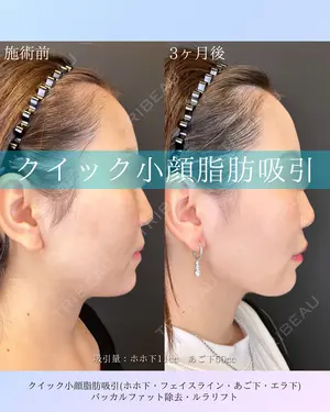 null days after image