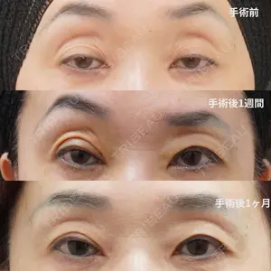 before image