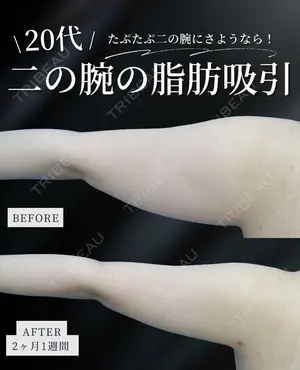 null days after image