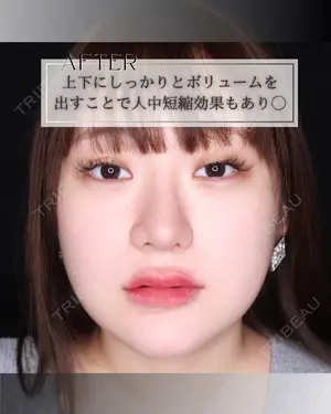 null days after image