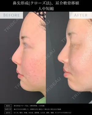 null days after image