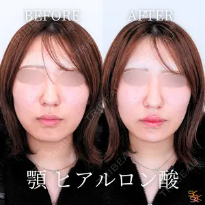 null days after image