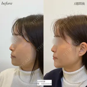 null days after image