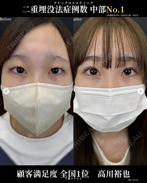 null days after image