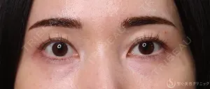 180 days after image