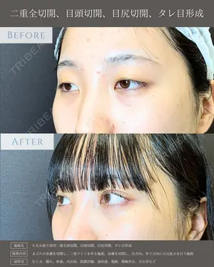 null days after image