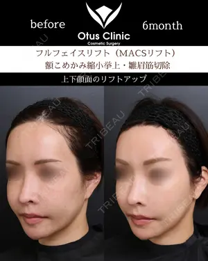 180 days after image