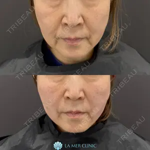 null days after image