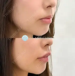 null days after image