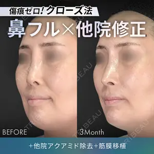 90 days after image