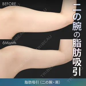 180 days after image