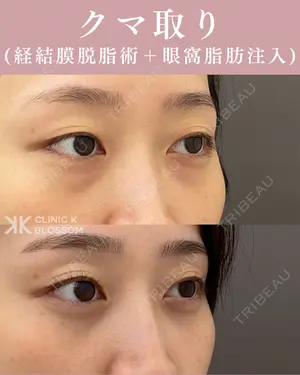 null days after image