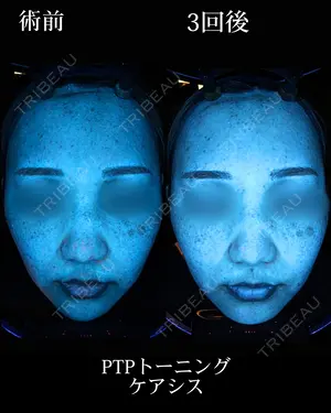 120 days after image