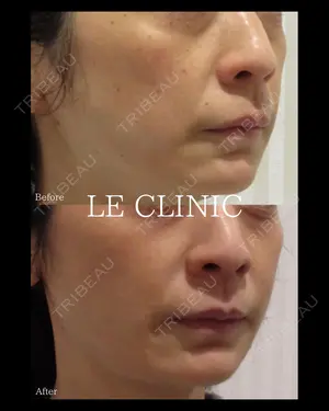 null days after image