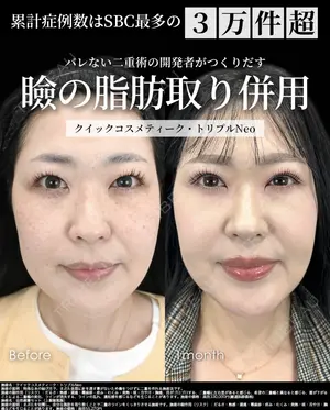 null days after image