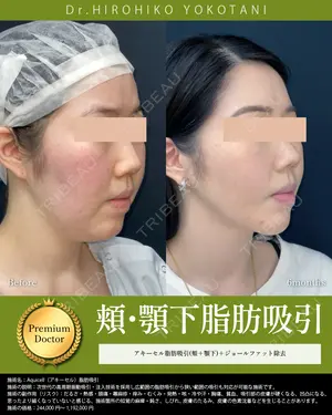 180 days after image