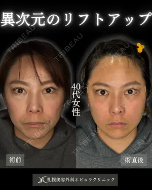 null days after image