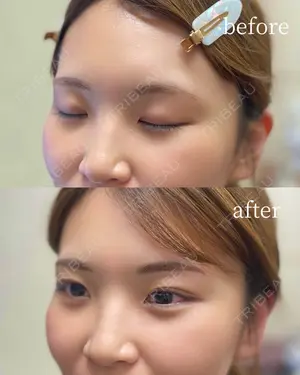 null days after image