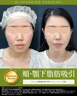 180 days after image