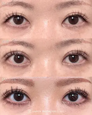 null days after image