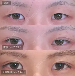 null days after image