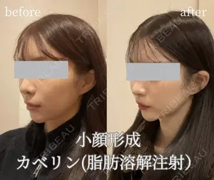 null days after image