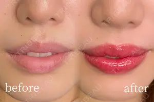 null days after image