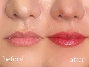 null days after image