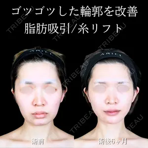 180 days after image