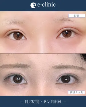 null days after image