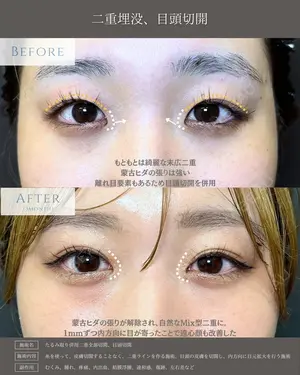 null days after image