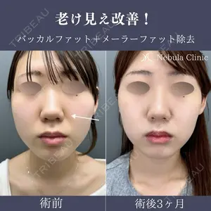 null days after image