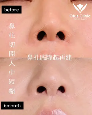 180 days after image