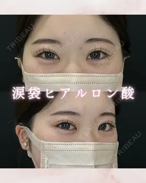 0 days after image