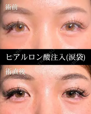 null days after image