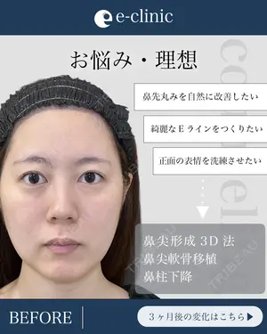 null days after image