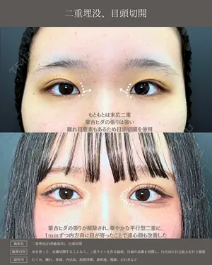 null days after image