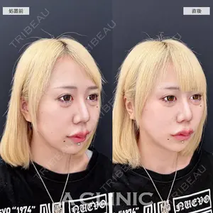 null days after image