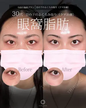 null days after image