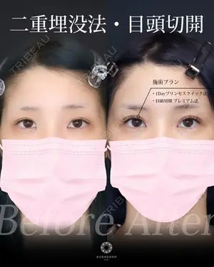 null days after image