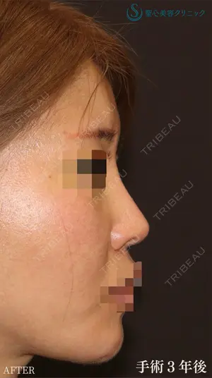 null days after image