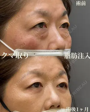 null days after image