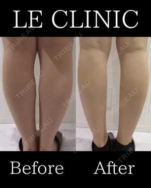 null days after image