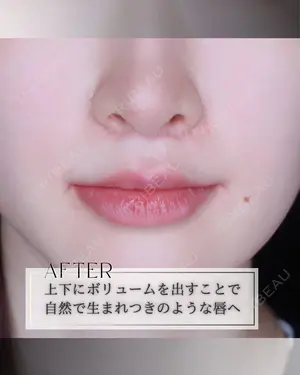 null days after image