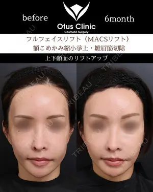 180 days after image